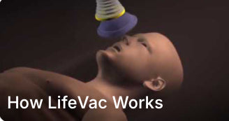 Charger la vidéo : 